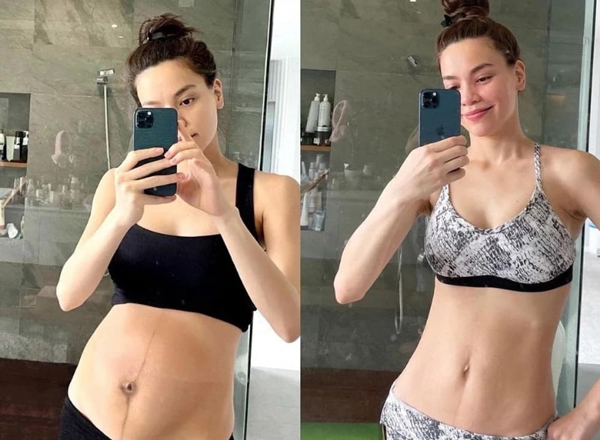 Bộ Ủ Nóng Tan Mỡ Slimming Body SB-II