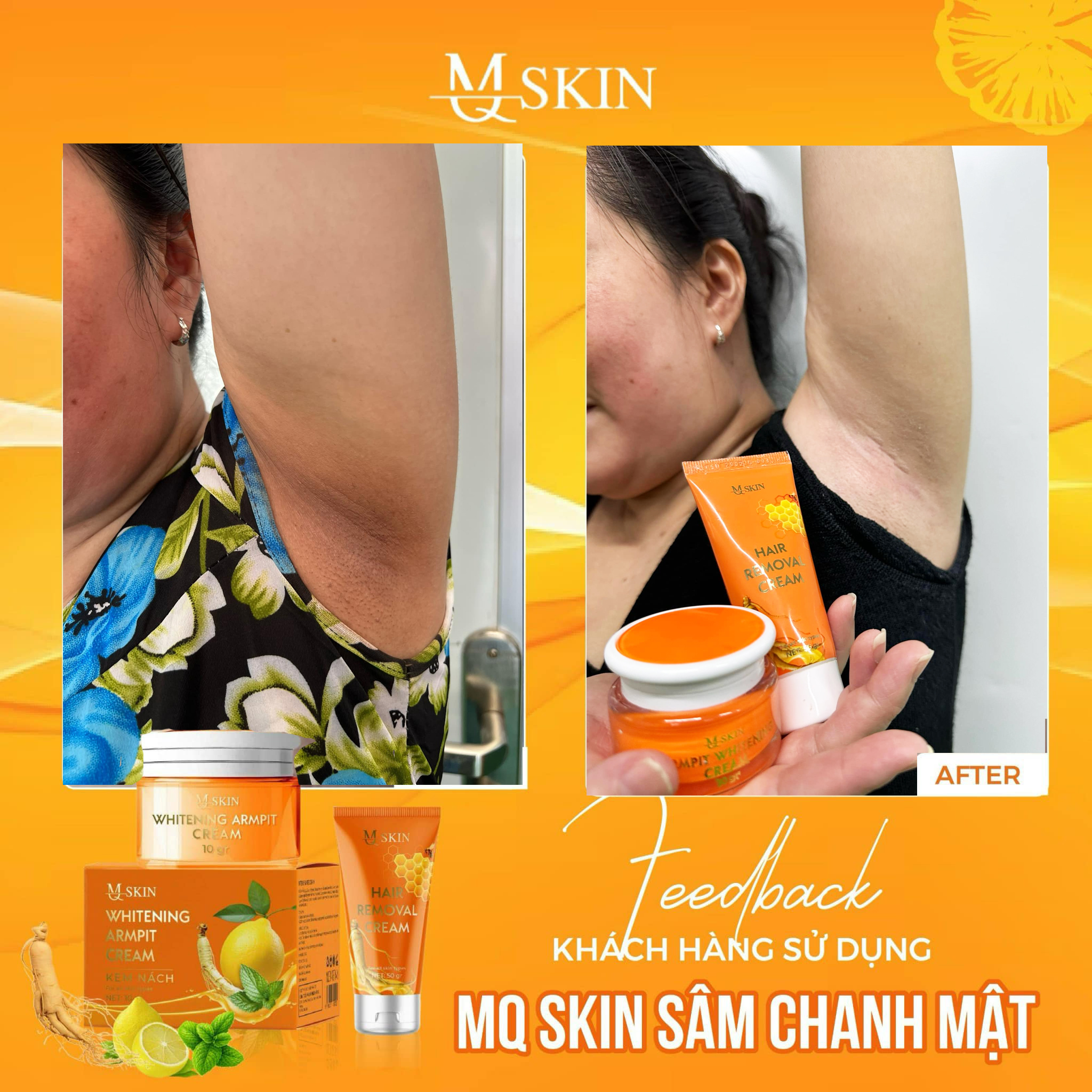 Combo Kem Tẩy Lông + Kem Thâm Nách MQ Skin Sâm Chanh Mật