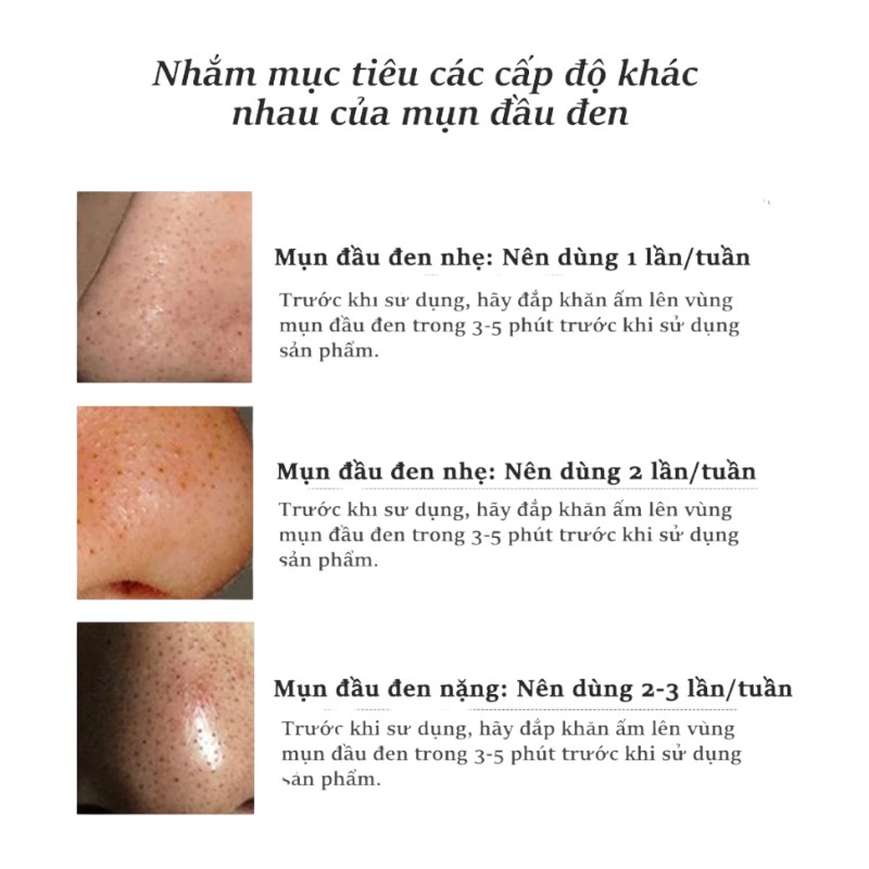 Gel lột mụn nha đam oke shop Acne Removal Gel 30g