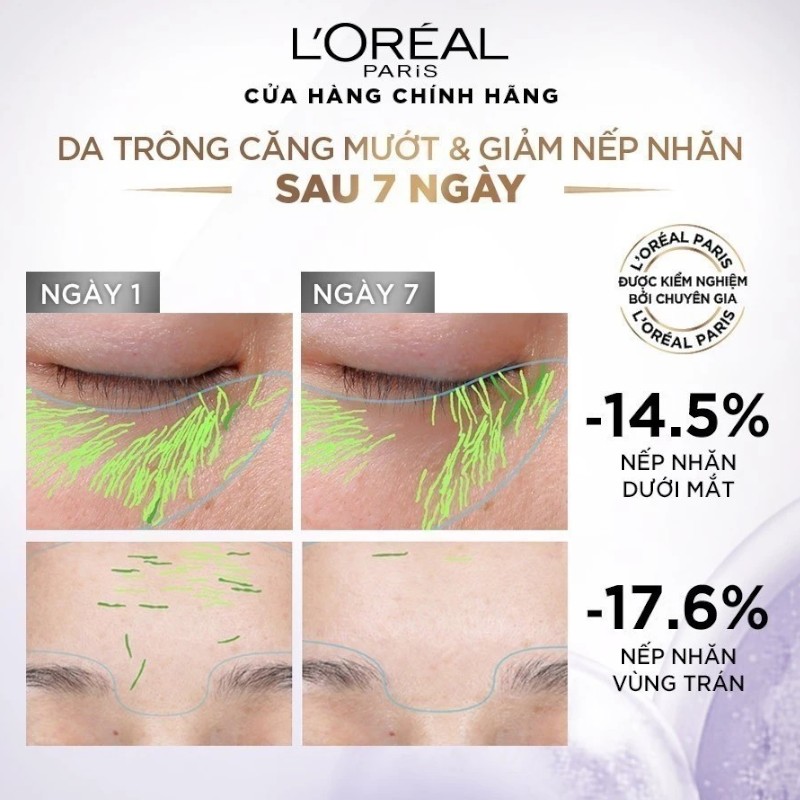 Hình ảnh so sánh hỗ trợ giảm nếp nhăn sau 7 ngày