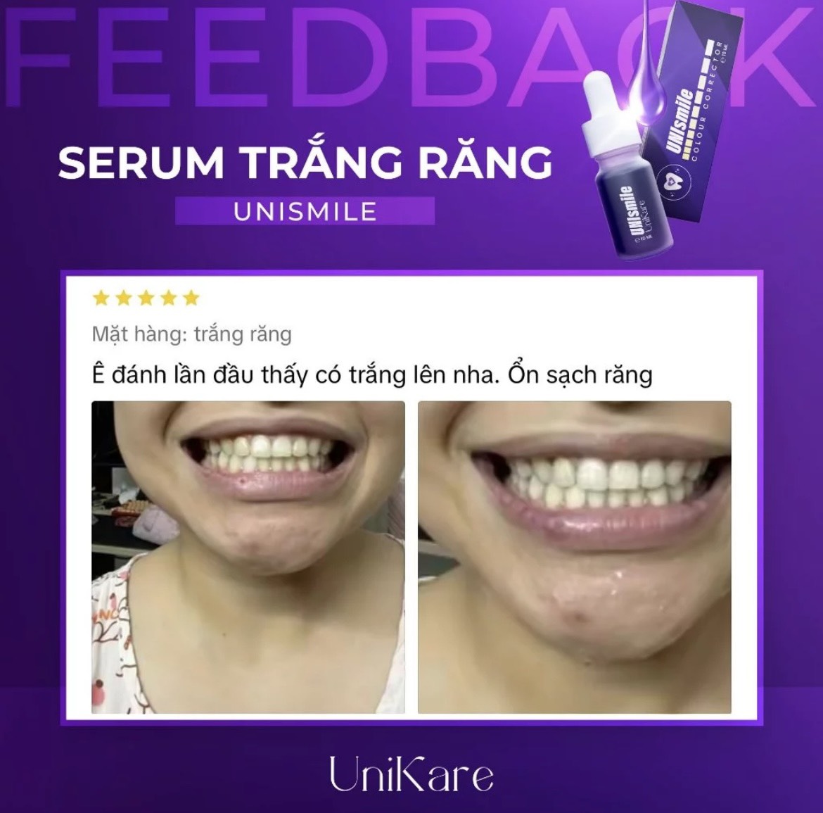 Serum Hỗ Trợ Trắng Răng Unismile UniKare 10ml