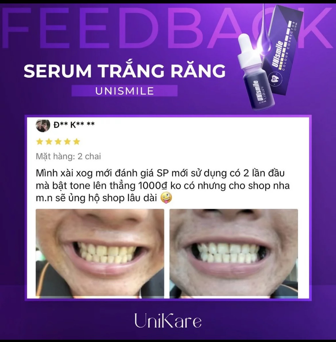 Serum Hỗ Trợ Trắng Răng Unismile UniKare 10ml