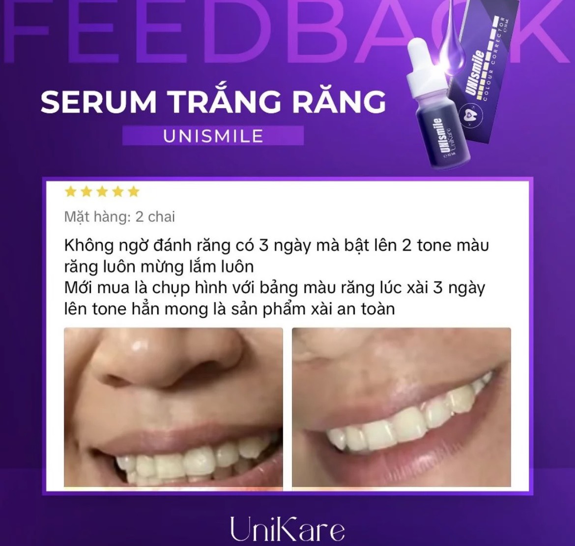 Serum Hỗ Trợ Trắng Răng Unismile UniKare 10ml