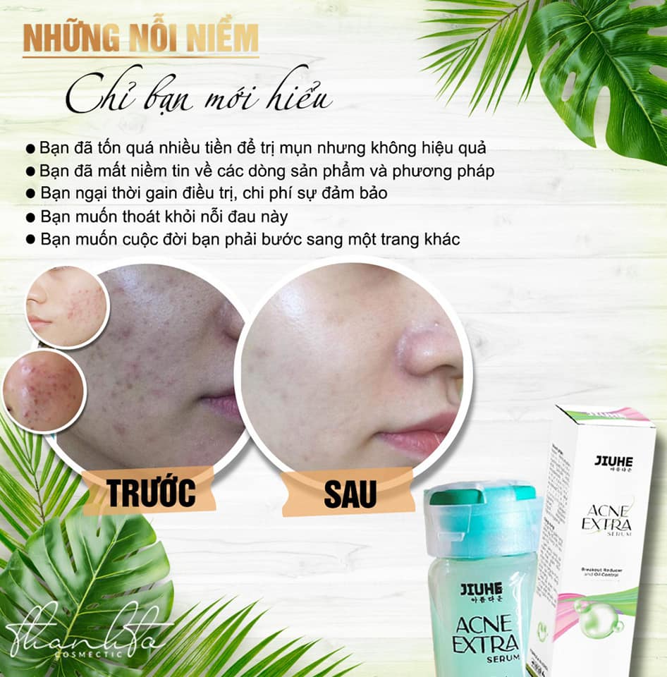 Serum giảm mụn Jiuhe Acne Extra 5ml Extra Thanh Tô Cosmetics