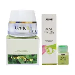 Combo Giảm Mụn Kem Face Rau Má Centella Ance Jiuhe và Serum Acne Extra Jiuhe Thanh Tô Cosmetics