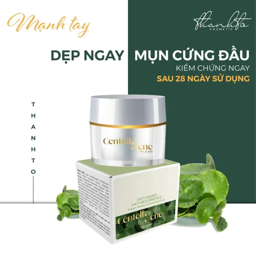 Combo Giảm Mụn Kem Face Rau Má Centella Ance Jiuhe và Serum Acne Extra Jiuhe Thanh Tô Cosmetics