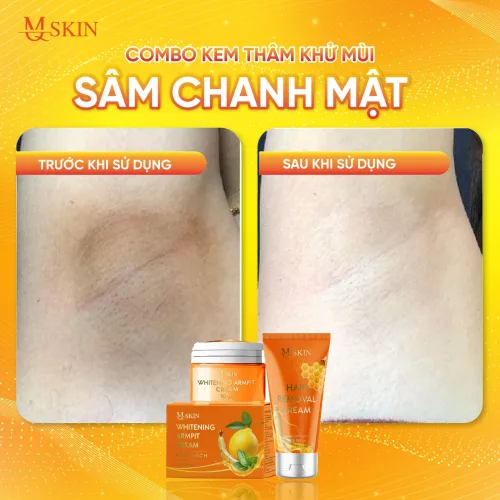 Combo Kem Tẩy Lông + Kem Thâm Nách MQ Skin Sâm Chanh Mật