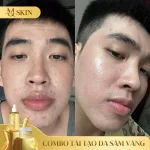 Combo Tái Tạo Sâm Vàng MQ Skin