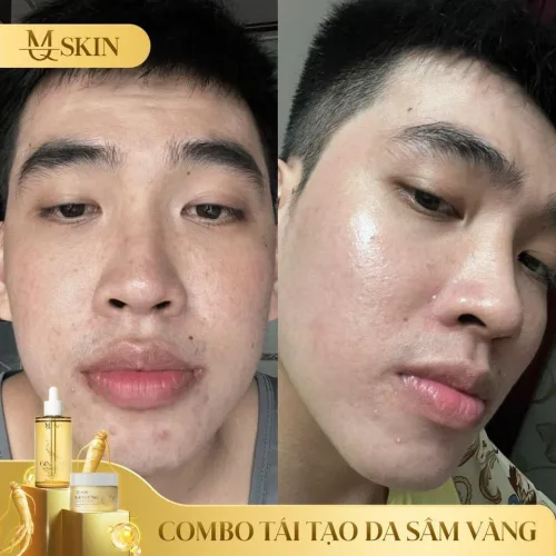 Combo Tái Tạo Sâm Vàng MQ Skin