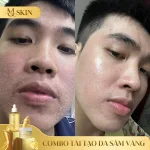 Combo Tái Tạo Sâm Vàng MQ Skin