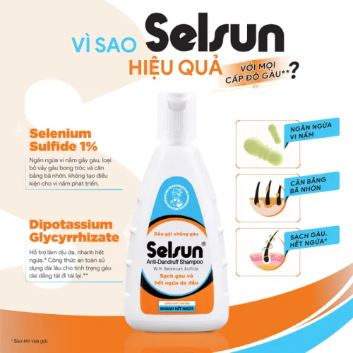 Dầu Gội Chống Gàu Selsun Anti-Dandruff 100ml - Dầu Gội Giảm Gàu Selsun
