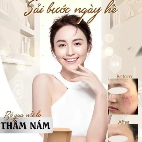 Kem Face Giảm Nám Jiuhe Luxury Thanh Tô Cosmetics  Bạn đồng hành cùng làn da của bạn