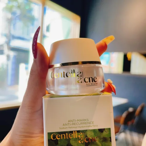 Kem Face Mụn Rau Má Jiuhe Centella Acne Thanh Tô Cosmetics 10g