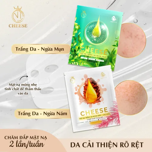 Mặt Nạ Trắng Da Ngừa Mụn Cheese Mỹ Phẩm Ngọc Tú NT Cosmetics