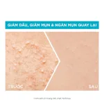Serum Garnier Giảm Mụn Sáng Da Skin Naturals Bright Complete Anti-Acne Booster Serum 30ml