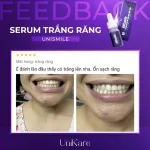 Serum Trắng Răng Unismile Unikare 10ml
