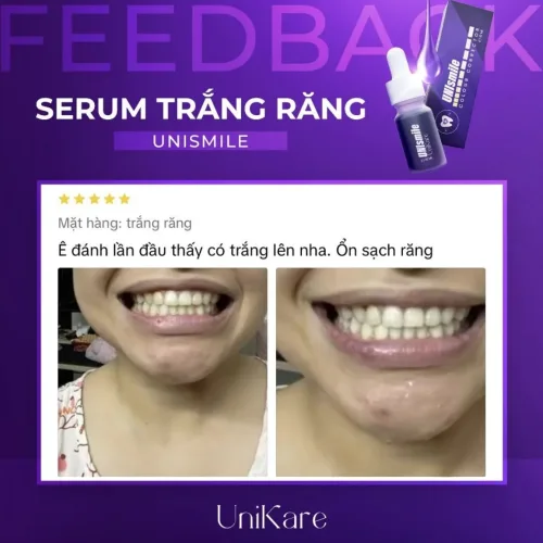 Serum Trắng Răng Unismile Unikare 10ml