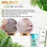 Serum giảm Mụn Jiuhe Acne Extra Thanh Tô Cosmetics
