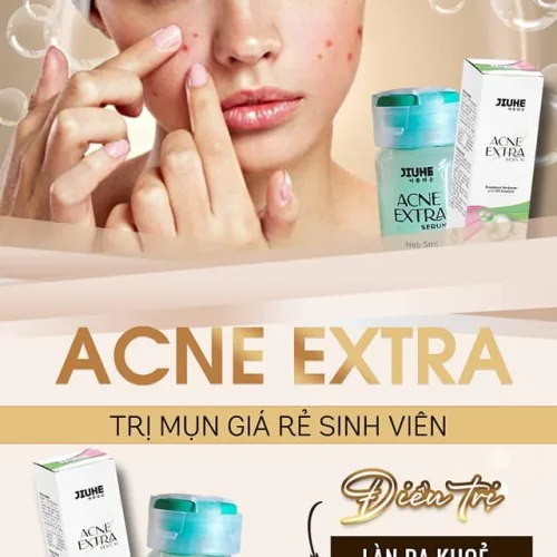 Serum giảm Mụn Jiuhe Acne Extra Thanh Tô Cosmetics