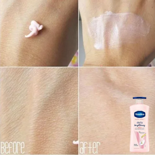 Sữa Dưỡng Thể Vaseline Intensive Care Daily Brightening 725ml