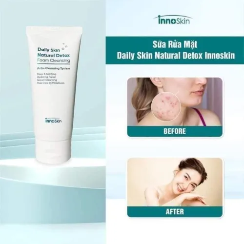 Tươi mới cả ngày với  Rửa Mặt Daily Skin Natural Detox InnoSkin Foam Cleansing