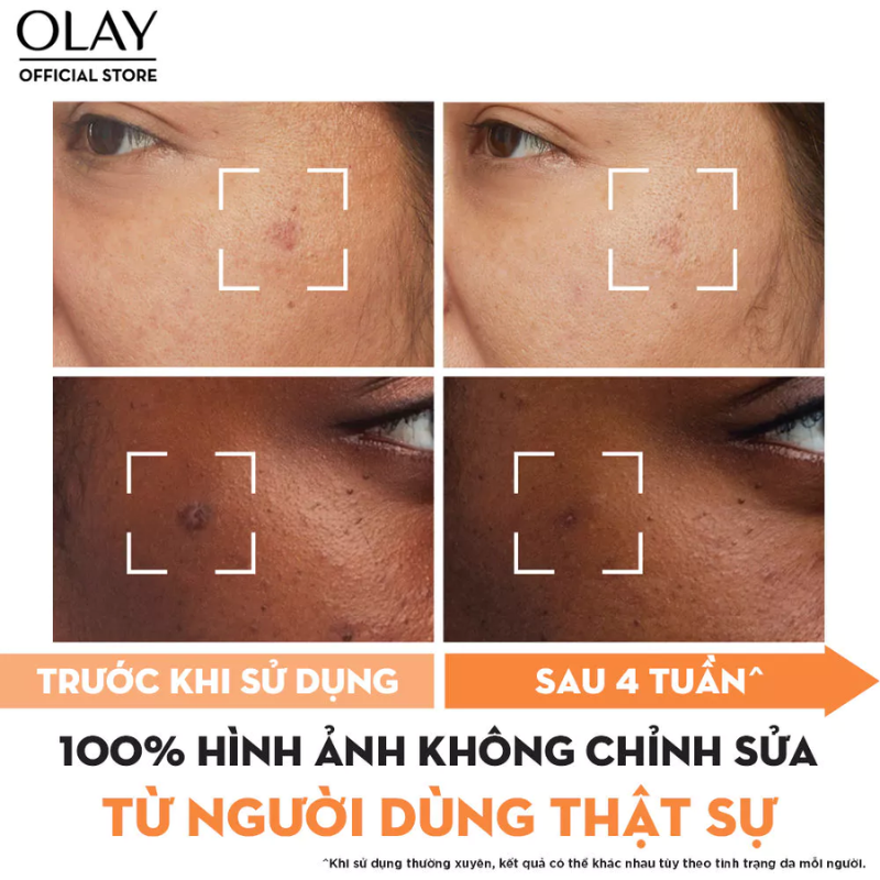 Hình minh họa kết quả cải thiện vẻ ngoài của vùng da sau thời gian sử dụng