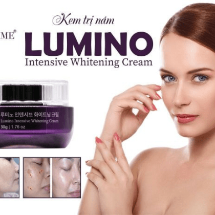Kem Nám Hàn Quốc Charme Lumino Intensive Whitening Cream điều trị hiệu quả cho tất cả các dạng nám tàn nhang và đốm nâu