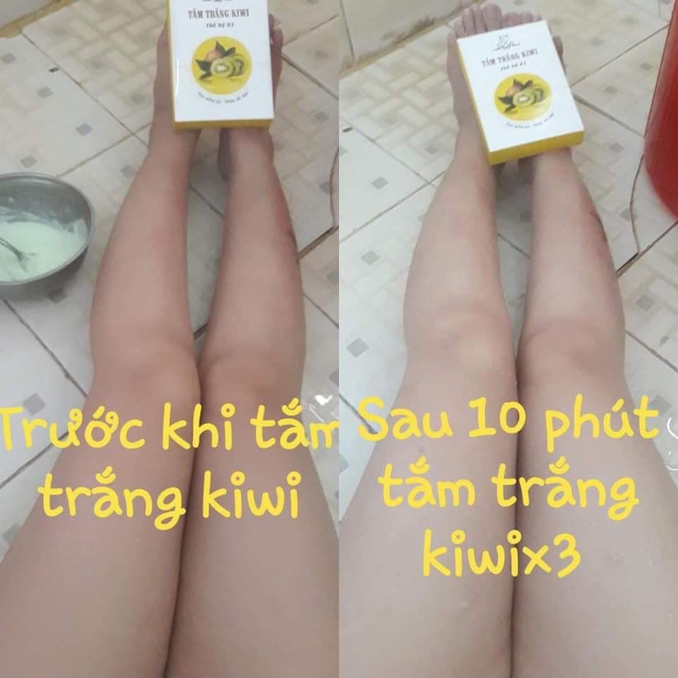 Tắm trắng da rõ rệt chỉ 85k cho 3 lần sử dụng "giải quyết" làn da đen sạm của bạn