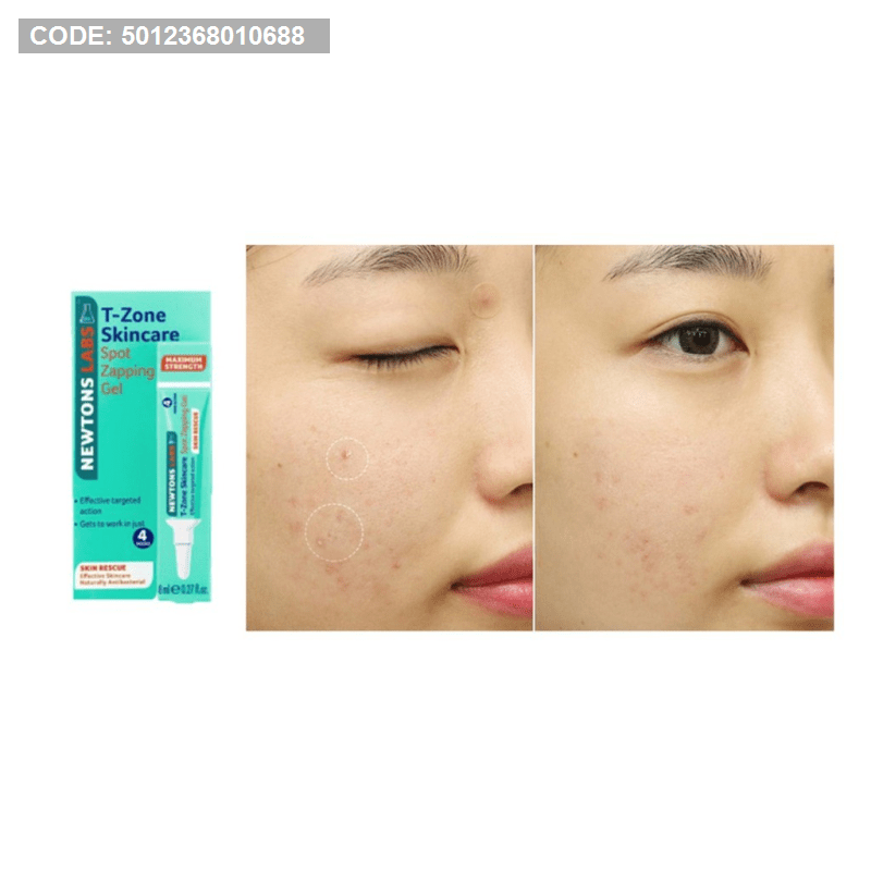 Gel hỗ trợ giảm mụn cấp tốc T-Zone chính hãng Gel hỗ trợ giảm mụn cấp tốc T-Zone chính hãng