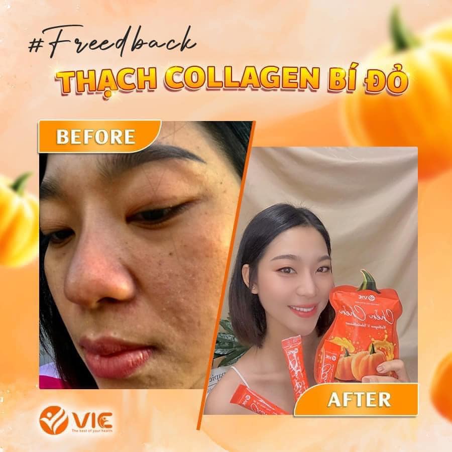 Thạch Bí Đỏ Chen Chen Vic chính hãng hỗ trợ giảm thâm nám Thạch Bí Đỏ Chen Chen Vic chính hãng hỗ trợ giảm thâm nám