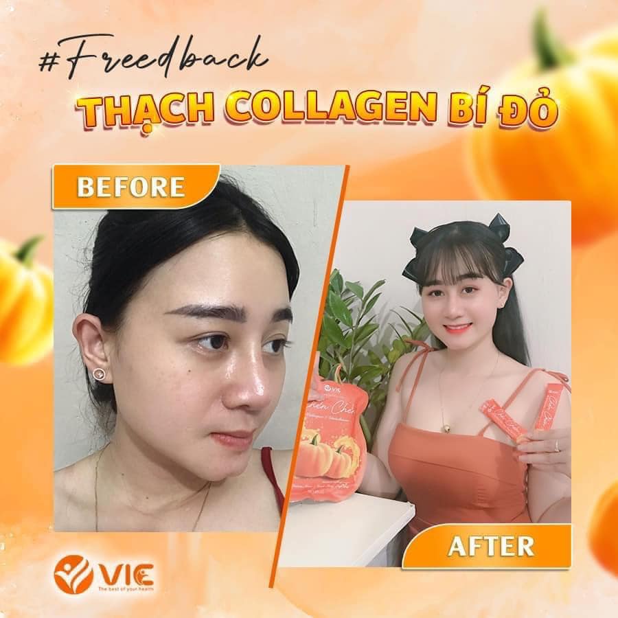 Thạch Bí Đỏ Chen Chen Vic chính hãng hỗ trợ giảm thâm nám Thạch Bí Đỏ Chen Chen Vic chính hãng hỗ trợ giảm thâm nám