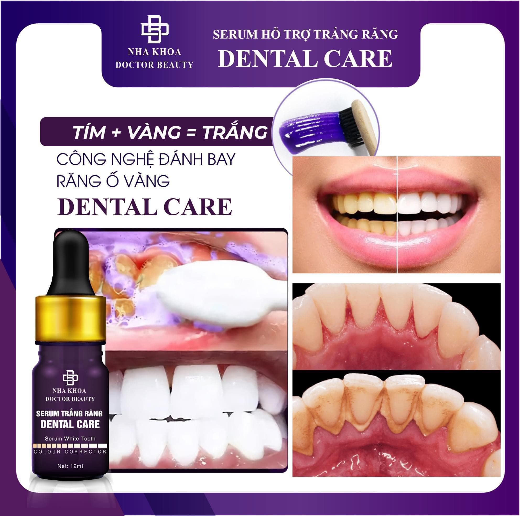 Chuyên sỉ combo 2 Chai Serum Dental Care Hỗ Trợ Trắng Răng Chuyên sỉ combo 2 Chai Serum Dental Care Hỗ Trợ Trắng Răng