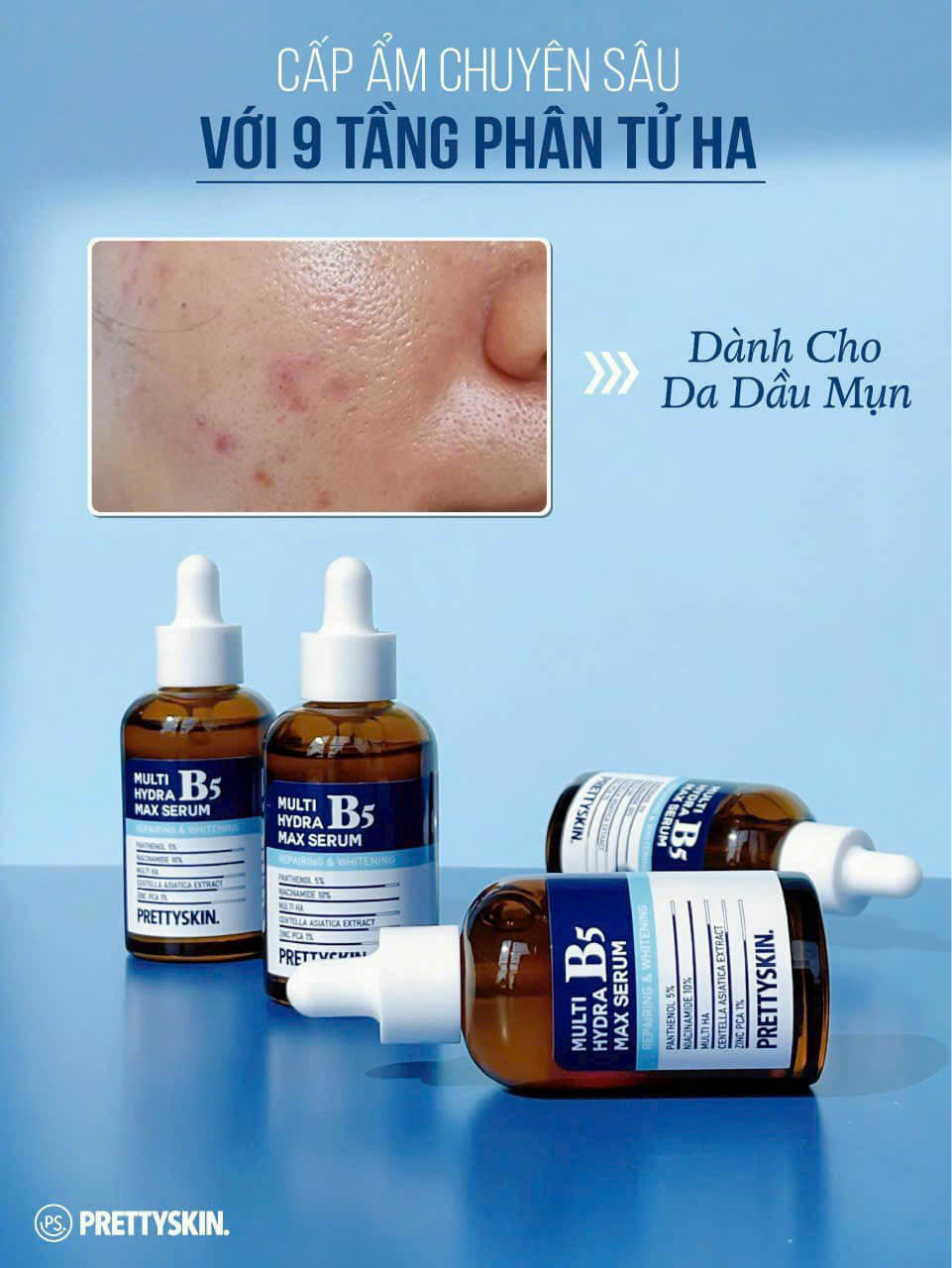 Serum B5 Prettyskin Multi Hydra Max Serum Cho Da Dầu Mụn 50ml Serum B5 Prettyskin Multi Hydra Max Serum Cho Da Dầu Mụn 50ml