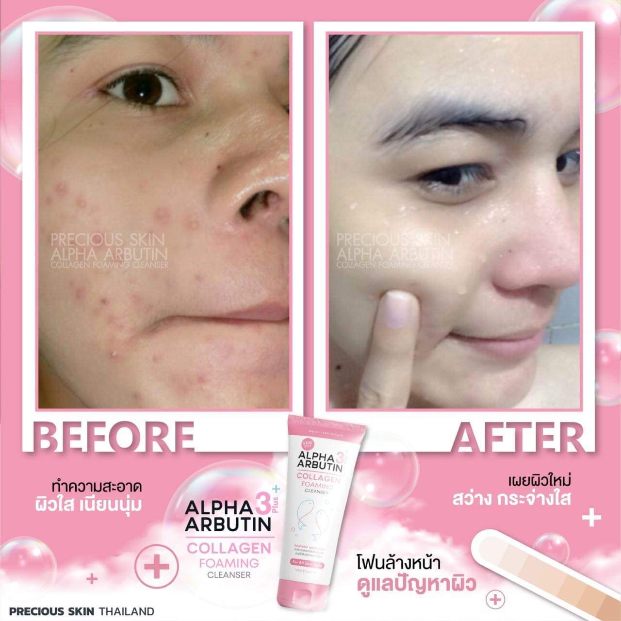 Sữa Rửa Mặt Trắng Da  Alpha Arbutin 3 Plus+ Precious Skin Thái Lan 120ml