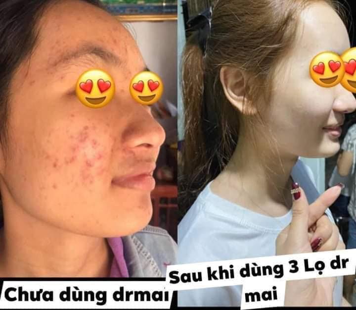 DR. MAI - DÙNG MỘT LẦN - YÊU MỘT ĐỜI