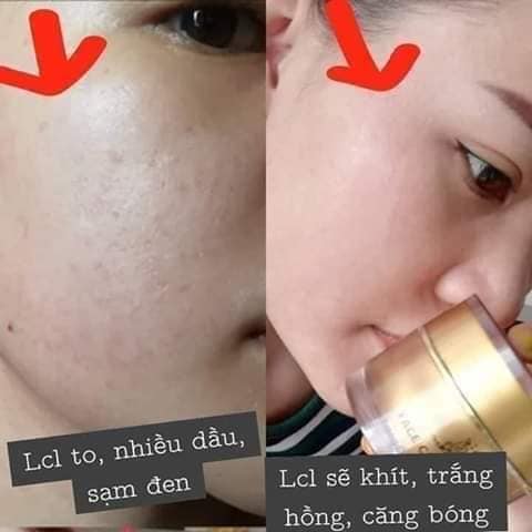 Nhà phân phối mỹ phẩm KEM FACE COLLAGEN X3 của cty Đông Anh
