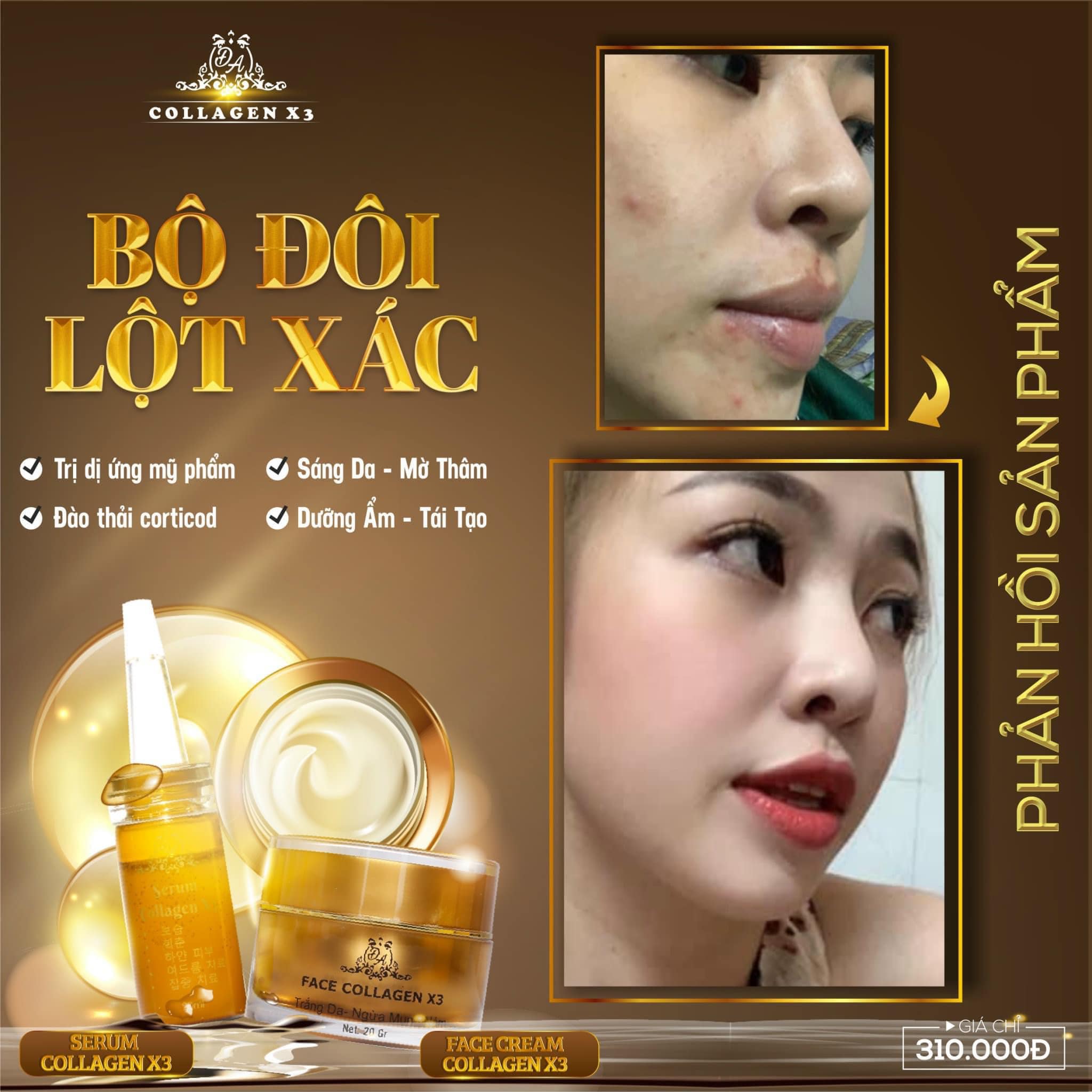 Combo Duỡng Da Trị Nám + Chống nắng Nọc Ong Collagen X3