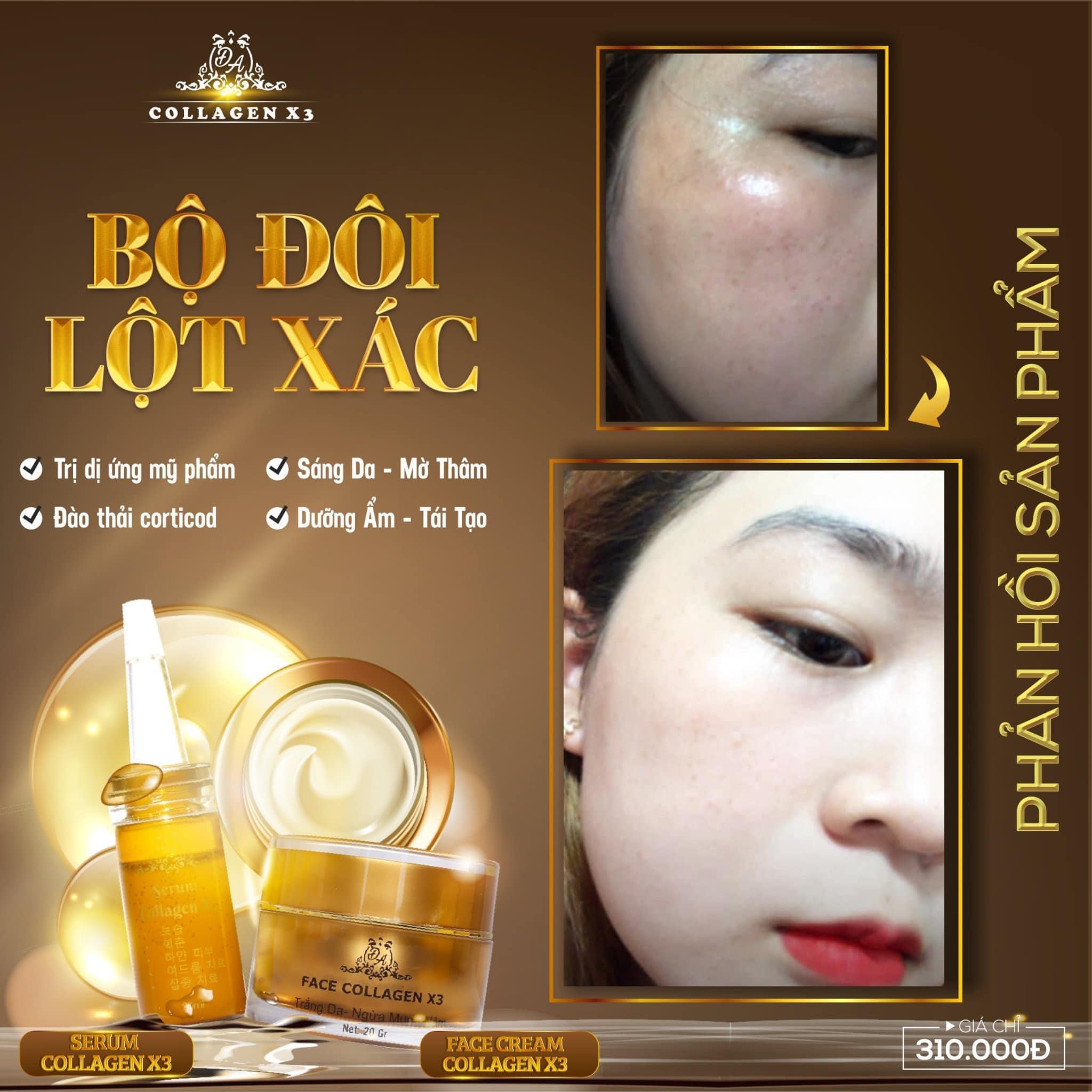 Combo Duỡng Da Trị Nám + Chống nắng Nọc Ong Collagen X3