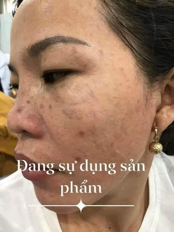 ''𝖵ịt '' һóа ''Thiên Nga'' vớ𝗂 1 ⅼ𝗂ệu trình dưỡng da chống lão hoá DAKAMI