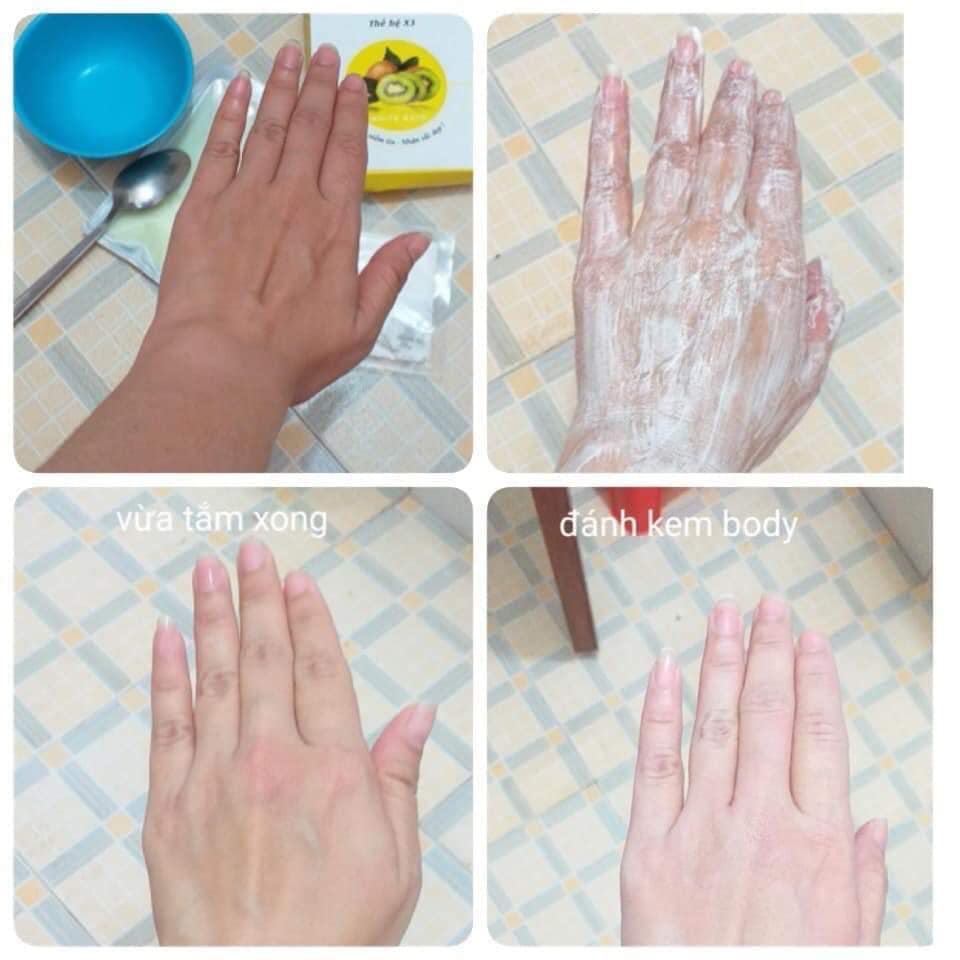 Tắm trắng da rõ rệt chỉ 85k cho 3 lần sử dụng "giải quyết" làn da đen sạm của bạn