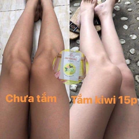 Tắm trắng da rõ rệt chỉ 85k cho 3 lần sử dụng "giải quyết" làn da đen sạm của bạn