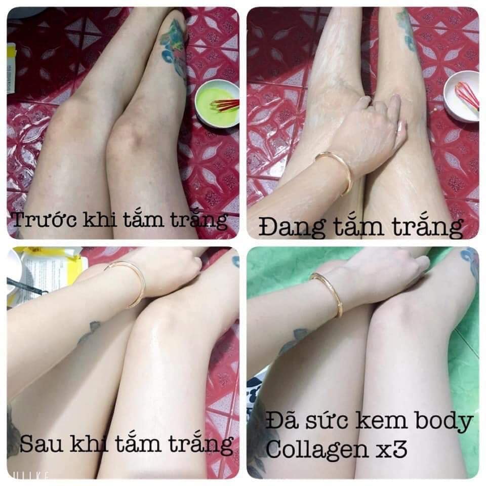 Tắm trắng da rõ rệt chỉ 85k cho 3 lần sử dụng "giải quyết" làn da đen sạm của bạn