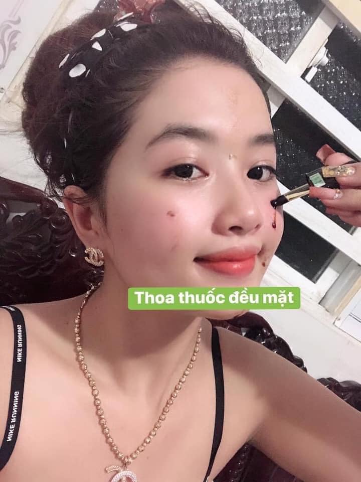 DR MAI - Thuốc trị mụn hiệu quả an toàn