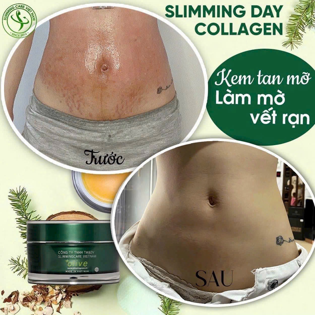 Bộ ủ nóng thải mỡ Slimming Body Sb2 Bộ ủ nóng thải mỡ Slimming Body Sb2