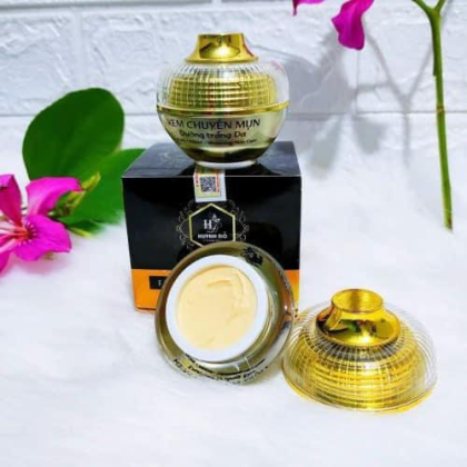 Mụn thường xuyên tái lại Là tại bạn chưa biết đến  Kem Face chuyên mụn trắng da
