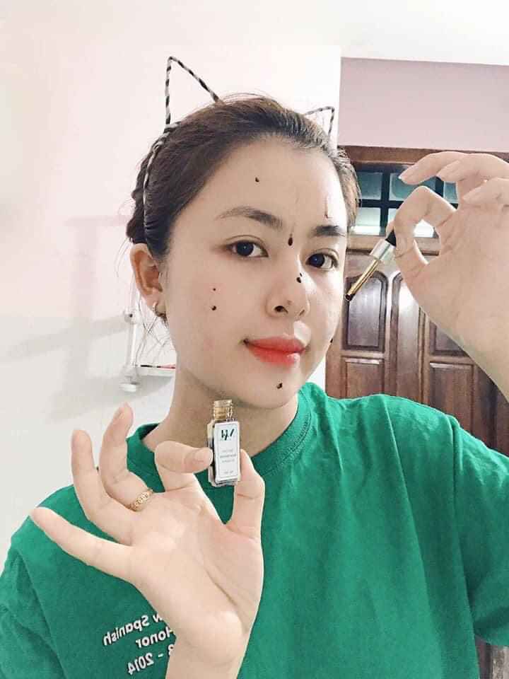 Trị mụn Dr Mai - Tiết kiệm thời gian - Giảm nhiều chi phí điều trị